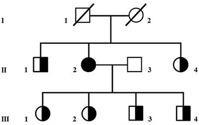 Reversible Valproate-Induced Subacute Encephalopathy Associated With a MT-ATP8 Variant in the Mitochondrial Genome